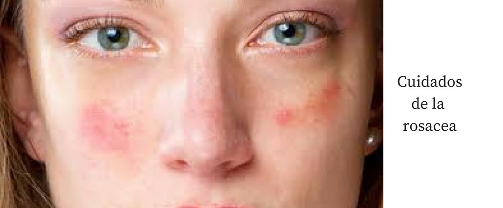 cuidado-rosacea-cosmetica-natural-geacosmetics